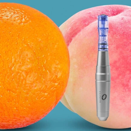 Hebe Day Spa Clinita Rigenera Microneedling.